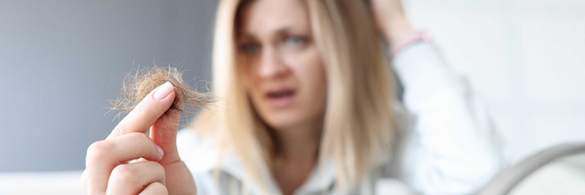 donna che perde i capelli