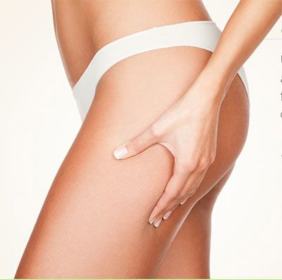 gambe prive di cellulite