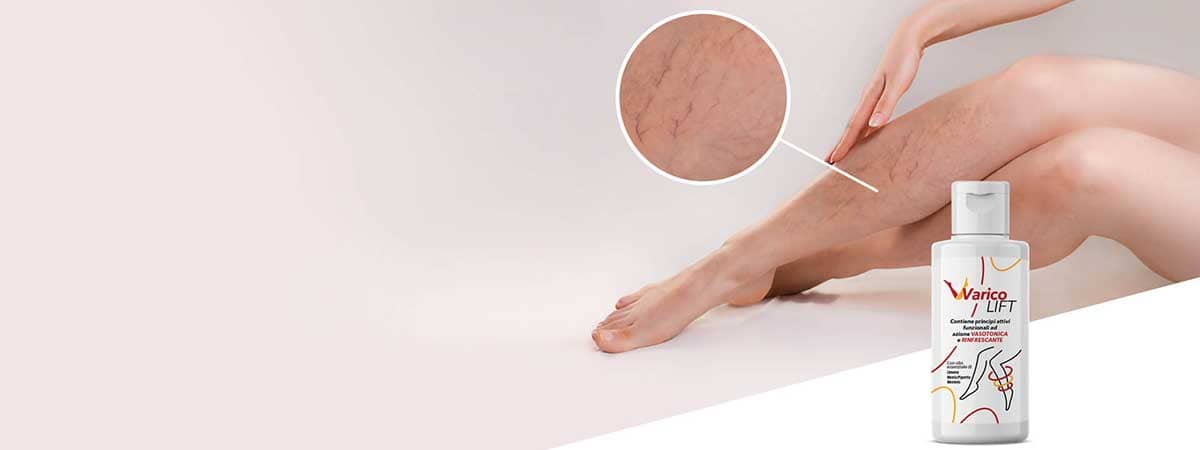 gambe di donna con confezione varicolift